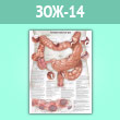 Плакат «Колоректальный рак» (ЗОЖ-14, ламинир. бумага, A1, 1 лист)